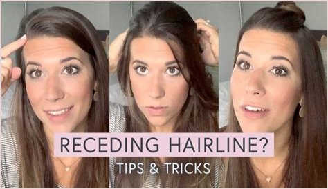 What hairstyle is best for receding hairline?